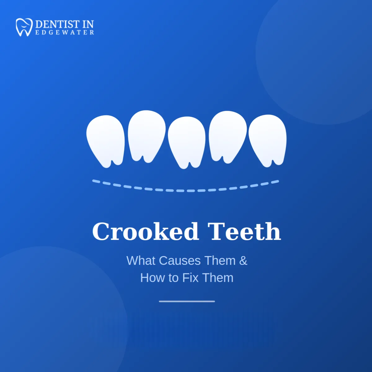 What Causes Crooked Teeth and How Can You Fix Them?