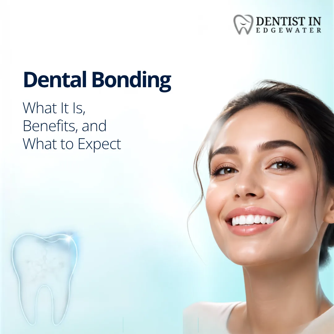 Dental Bonding: What It Is, Benefits, and What to Expect