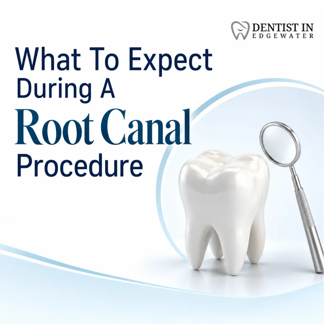 What To Expect During A Root Canal Procedure
