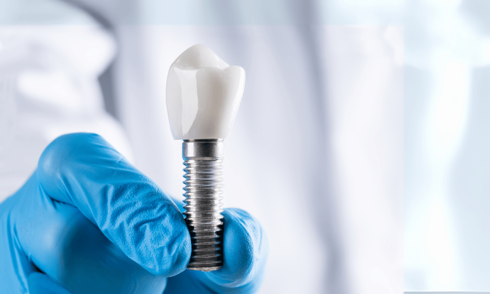 Why Choose Dentist in Edgewater for Dental Implants?